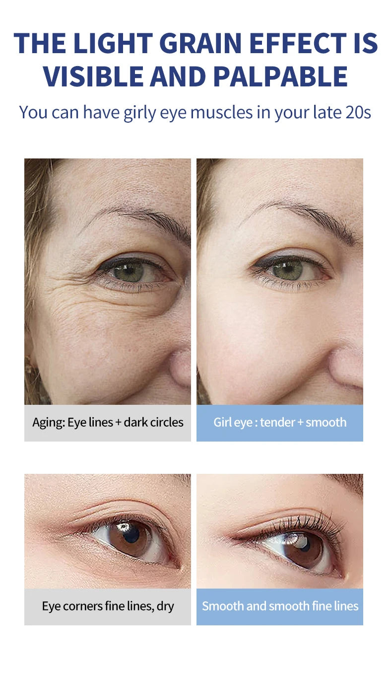 Electric Eye Cream