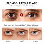RevitaEye™ by Lakerain