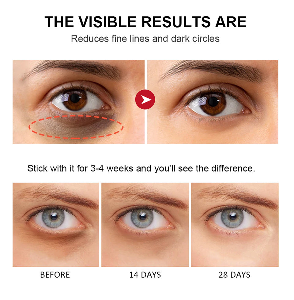 RevitaEye™ by Lakerain